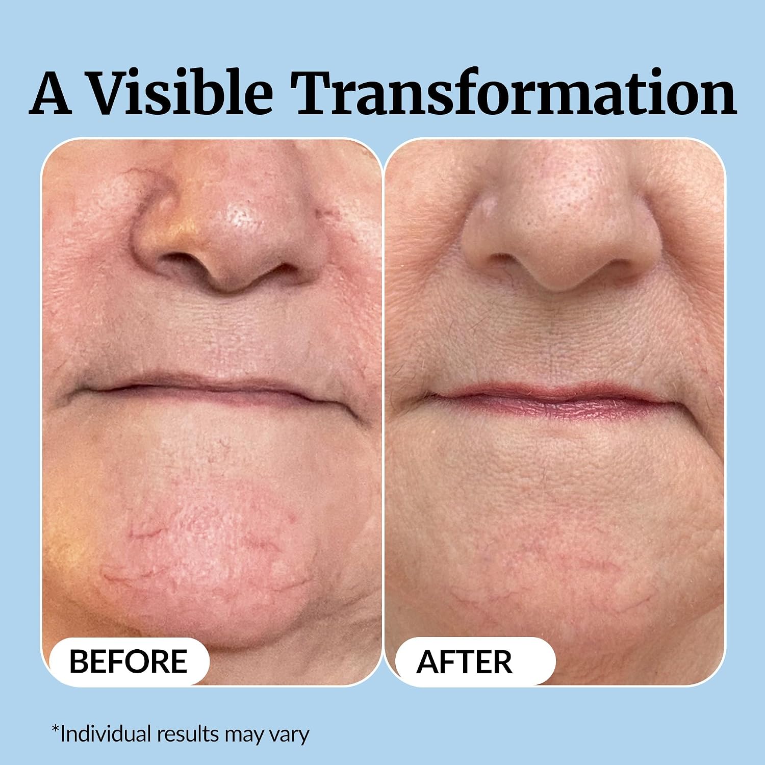 Vibriance Super C Serum for Mature Skin - All-in-One Vitamin Formula Hydrates, Firms, Lifts, Smooths, Targets Age Spots, Wrinkles, 1 fl oz - Pack of 3